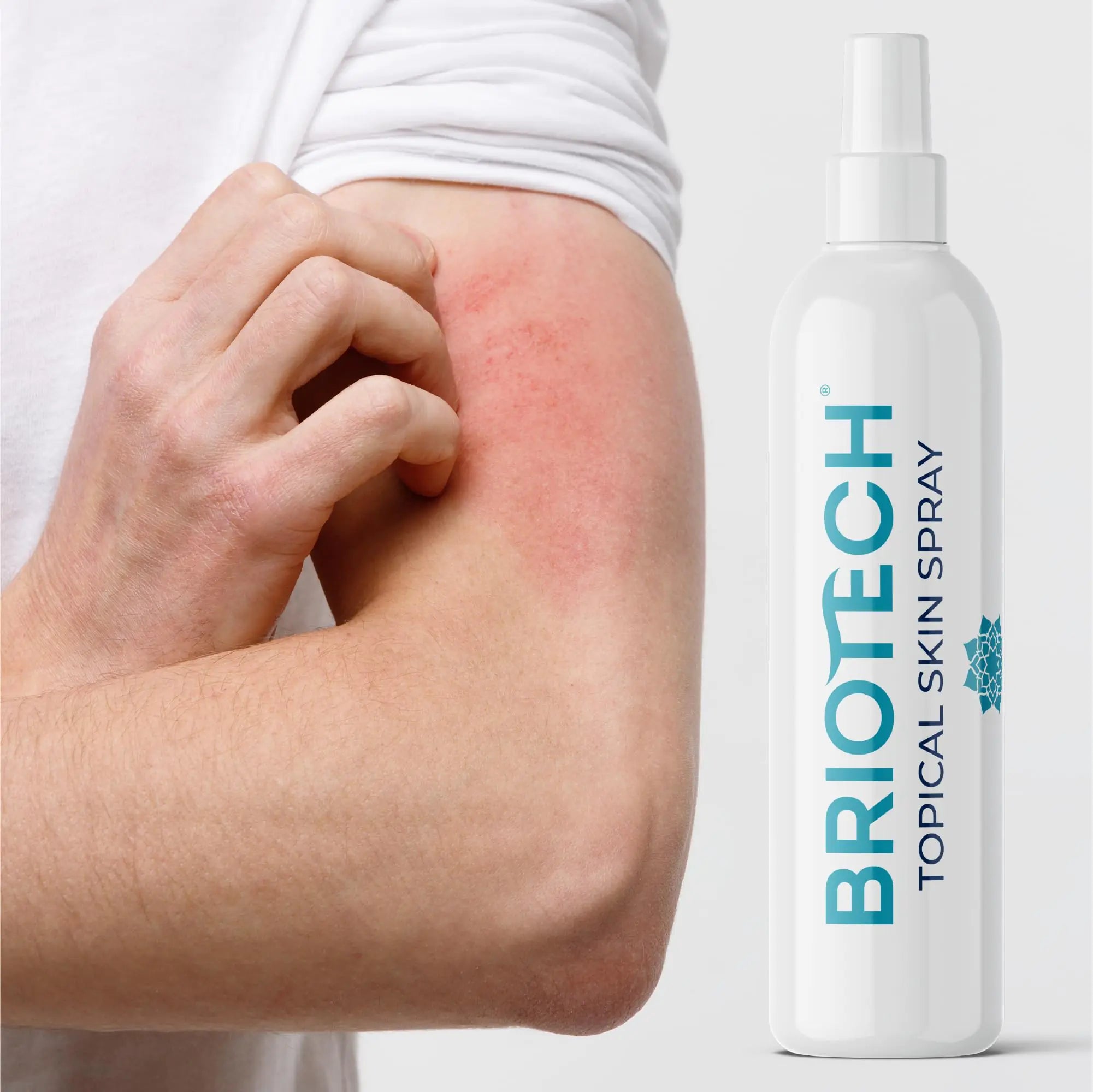 BRIOTECH Topical Skin Spray – Hypochlorous Acid for Face & Body, Eyelid Cleanser, Foot & Scalp Relief, 1 Liter Refill (33.8 Fl Oz)