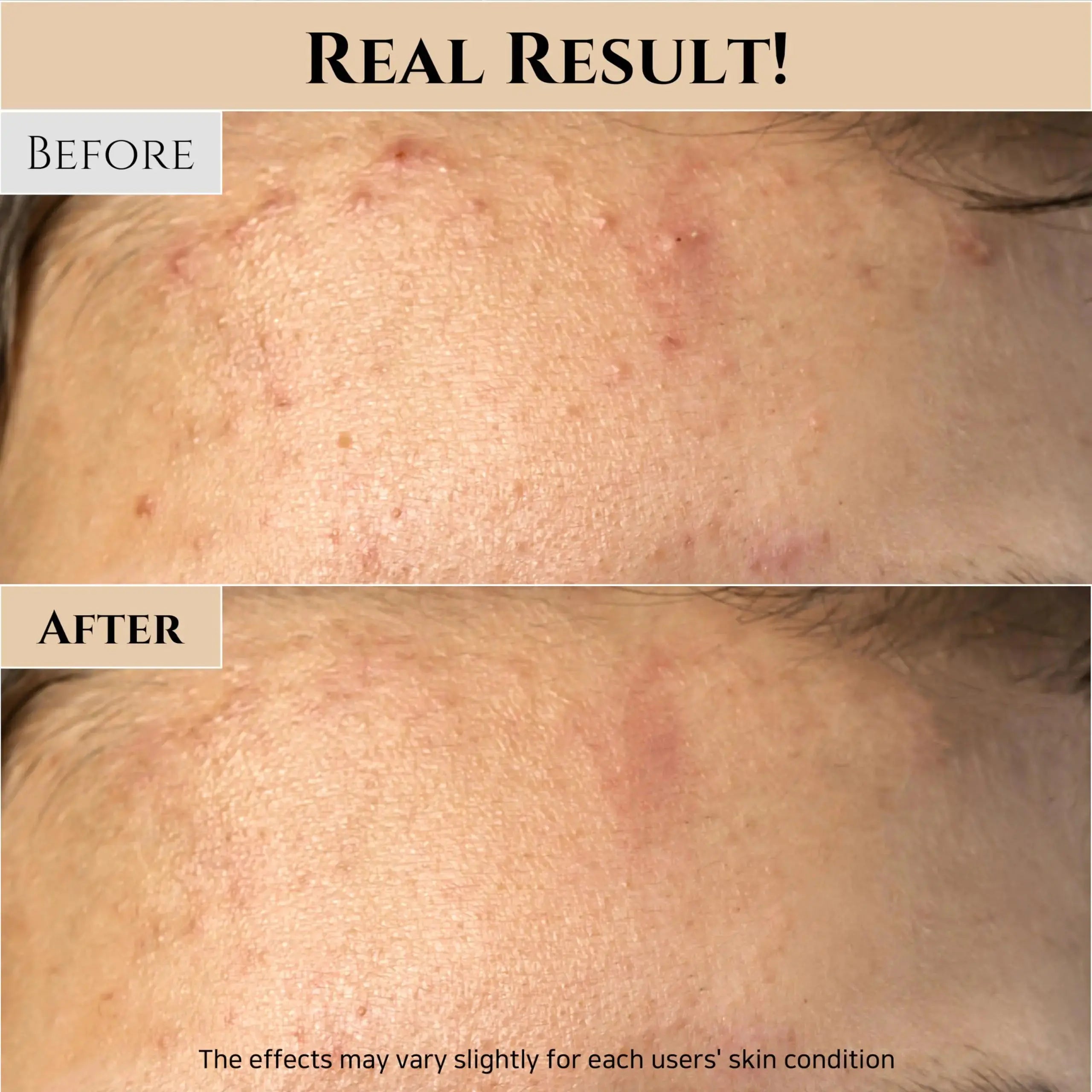 Beauty of Joseon Ground Rice and Honey Glow Mask Pore Sebum Care for Dry Sensitive Skin - Vivareflex Online