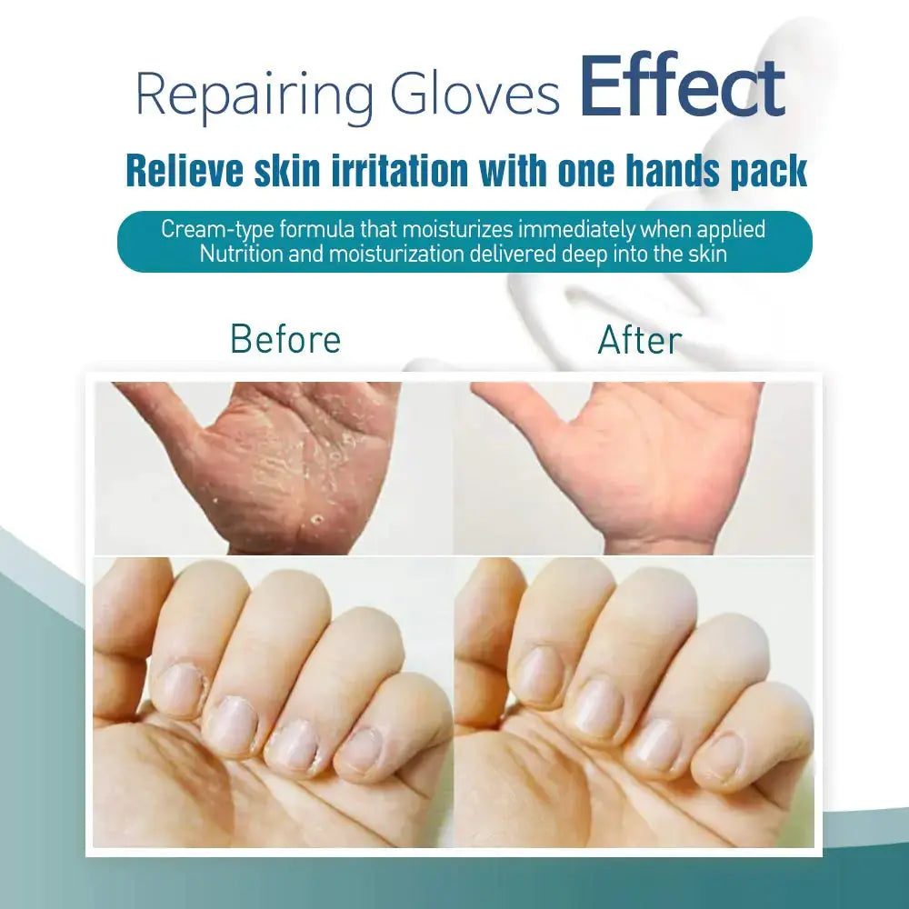 Epielle Intensive Repairing Hand Masks 6 Pack | Deep Moisture_Vivareflex_Online