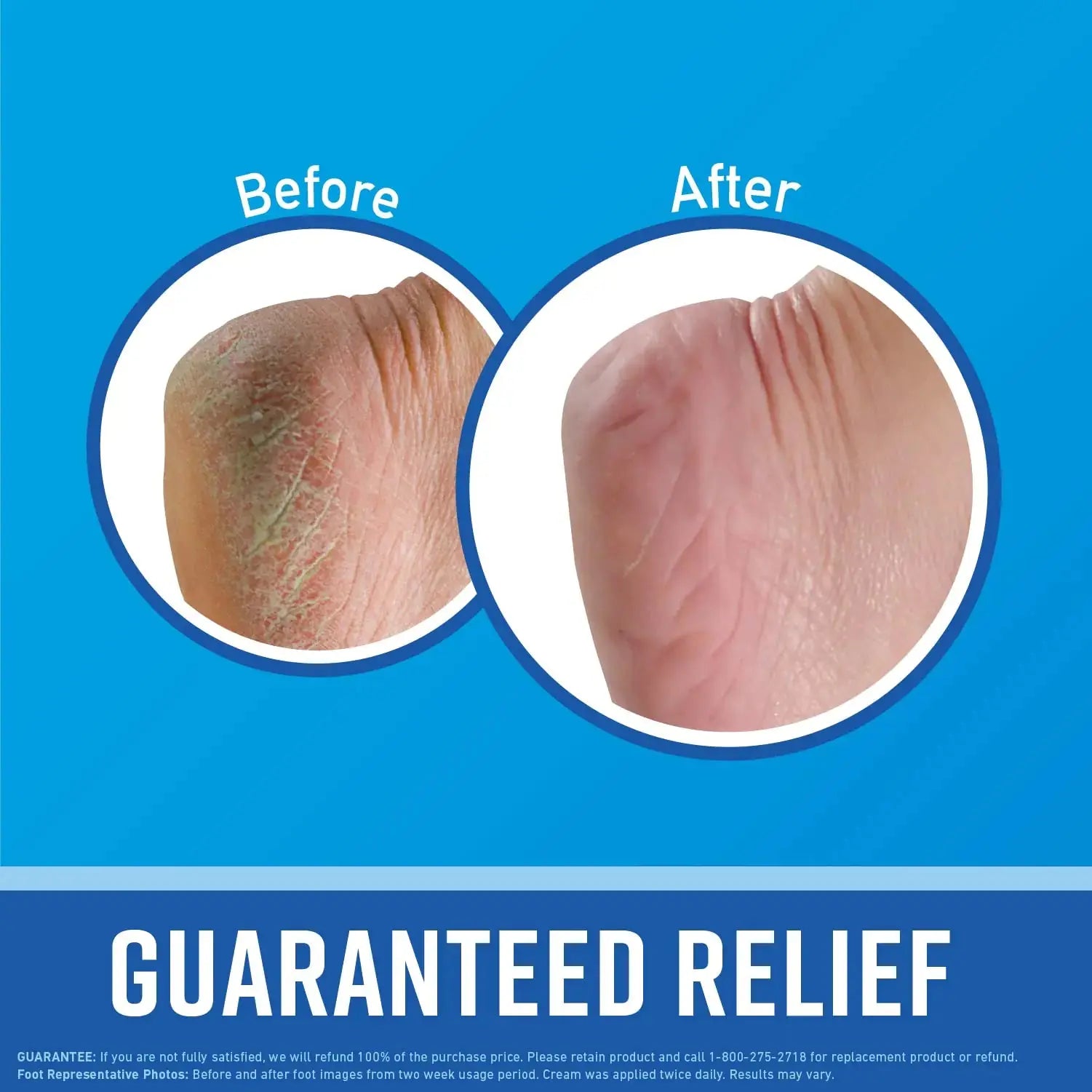 O'Keeffe's for Healthy Feet Foot Cream - Guaranteed Relief_Vivareflex_Online