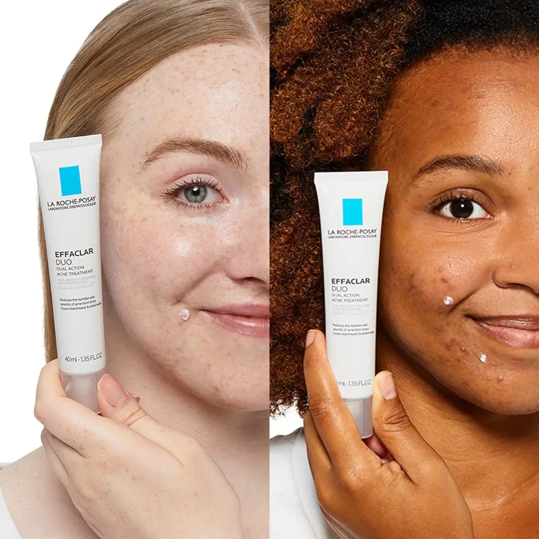 La Roche-Posay Effaclar Duo Crème de traitement localisée à double action contre l'acné avec peroxyde de benzoyle Traitement de l'acné pour l'acné et les points noirs, transparence légère, sans danger pour les peaux sensibles 0,7 fl oz (paquet de 1)