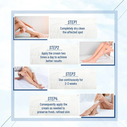 Urea Cream 40 Percent, Urea Foot & Hand Cream for Dry Cracked, 40 per Urea Lotion for Feet Maximum Strength (4 Packs) 5.29 Ounce (Pack of 4) - Vivareflex Online