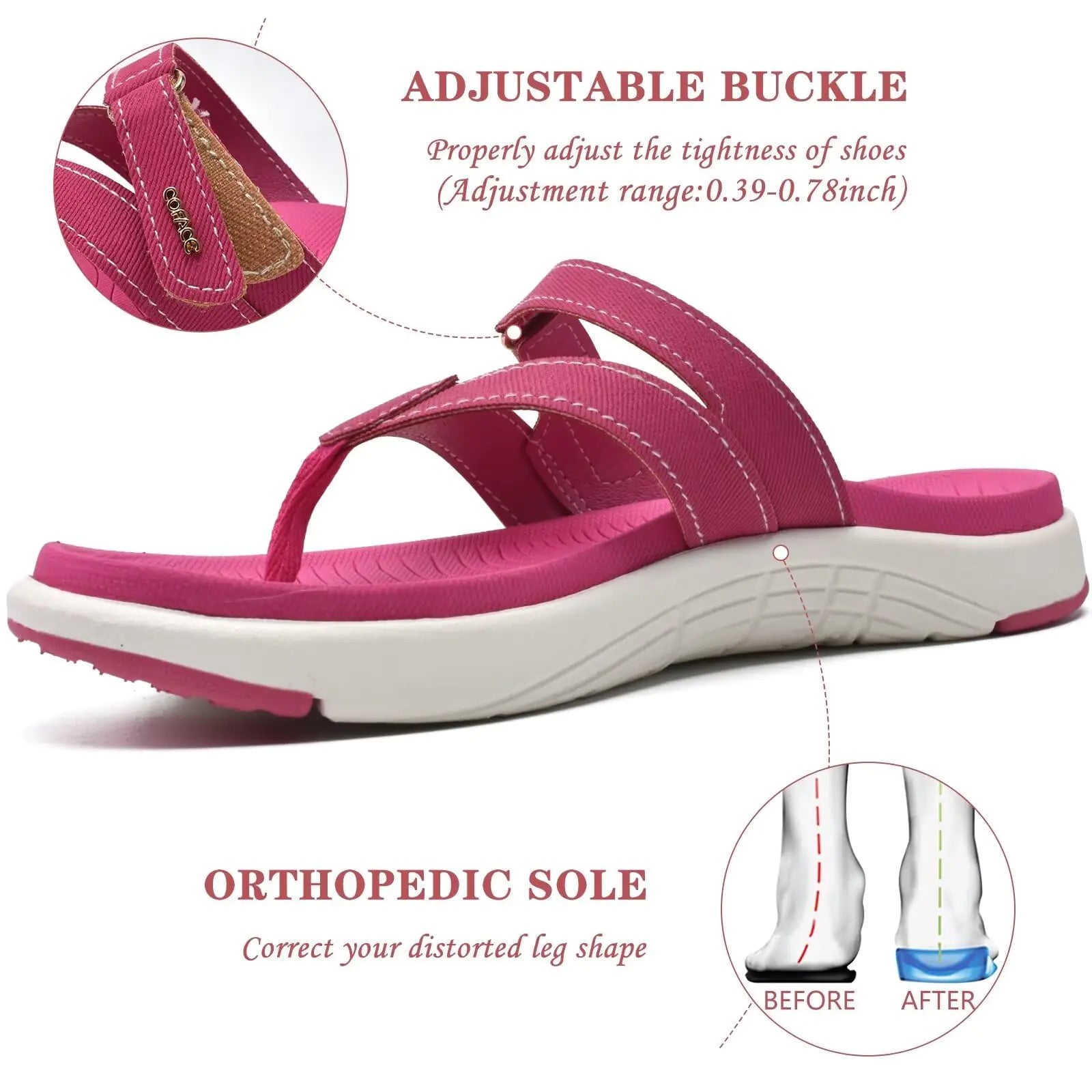 COFACE Women's Orthotic Flip Flops – Stylish Comfort with Arch Support - Vivareflex Online